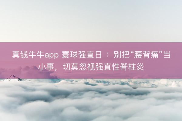 真钱牛牛app 寰球强直日 ：别把“腰背痛”当小事，切莫忽视强直性脊柱炎